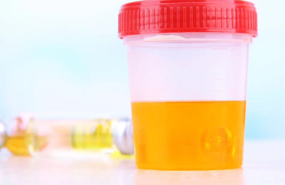 How a Simple Urine Test Could Spare Most Women from Invasive Womb Cancer Procedures