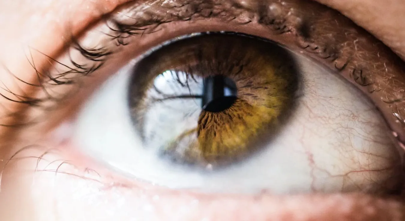 Common Cholesterol Medication May Help Shield Sight and Slow Glaucoma Progression